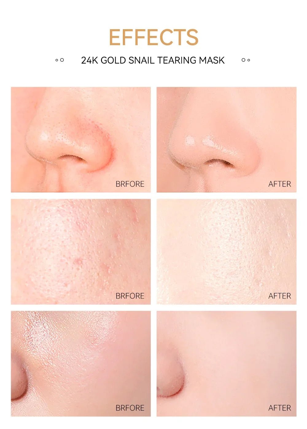 LAIKOU 24K Gold Sakura, Peeling Face Mask (Anti Wrinkle) - TonicTrove