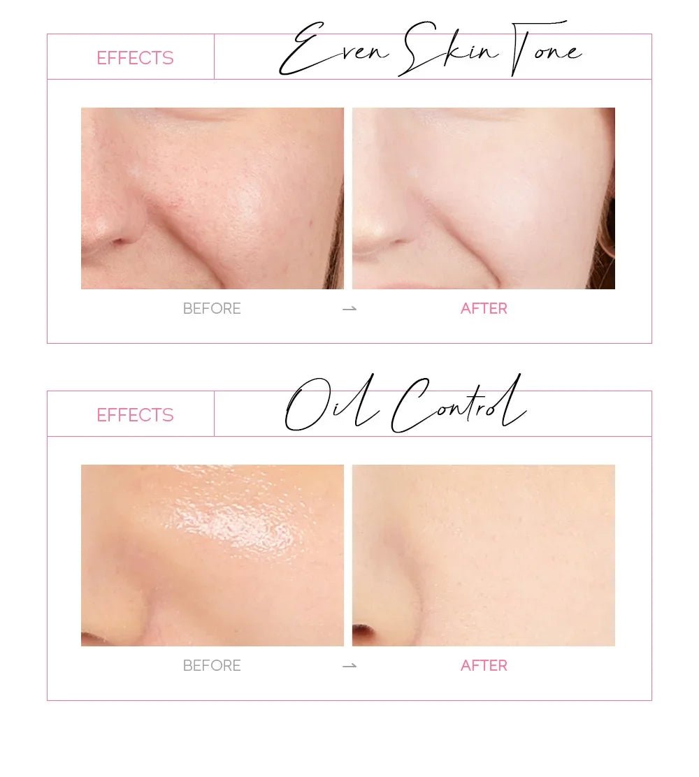 LAIKOU 24K Gold Sakura, Peeling Face Mask (Anti Wrinkle) - TonicTrove